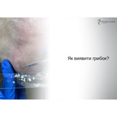 Як виявити грибок?