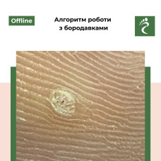 Курс «Алгоритм роботи з бородавками»