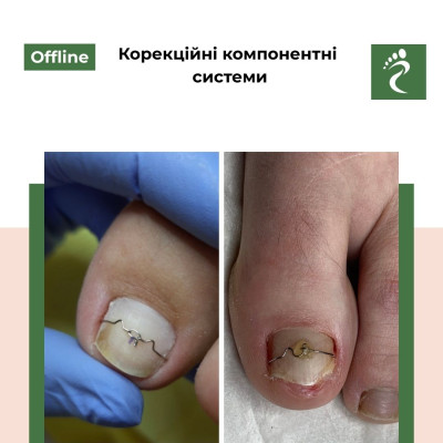 Курс «Корекційні компонентні системи»
