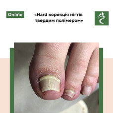 Онлайн курс «Hard  корекція нігтів твердим полімером»