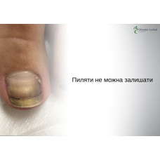 Пиляти не можна залишати